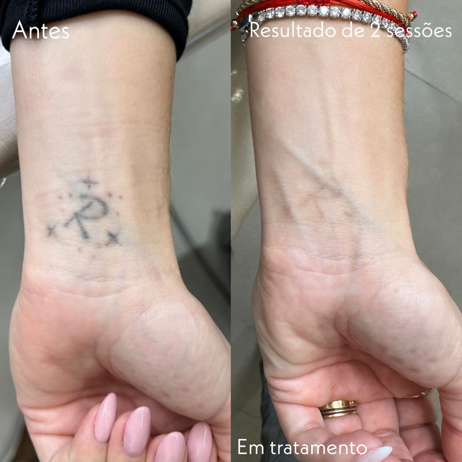Resultado Clínico 6 - Dr Jacson